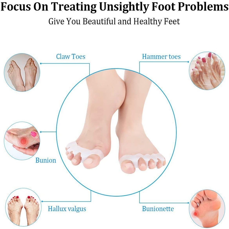 1 пара силиконовых разделителе – обзор и цена Women'S Shoes For Bunions